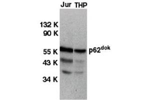 Western Blotting (WB) image for anti-Docking Protein 1, 62kDa (Downstream of tyrosine Kinase 1) (DOK1) (C-Term) antibody (ABIN1030364) (DOK1 抗体  (C-Term))