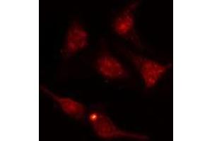 ABIN6277732 staining  HuvEc cells by IF/ICC. (NRF2 抗体  (pSer40))