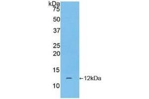 Detection of Recombinant CGa, Human using Polyclonal Antibody to Chorionic Gonadotropin Alpha Polypeptide (CGa) (CGA 抗体  (AA 25-116))