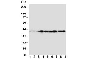 Western blot testing of CrkL antibody and rat samples 1: spleen (CrkL 抗体  (AA 286-303))