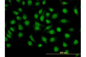 Immunofluorescence of monoclonal antibody to GMEB1 on HeLa cell.