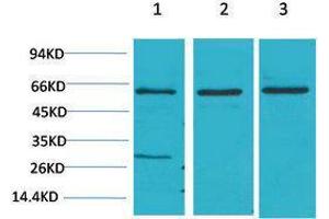 Western Blotting (WB) image for anti-V-Akt Murine Thymoma Viral Oncogene Homolog 2 (AKT2) antibody (ABIN3181588) (AKT2 抗体)