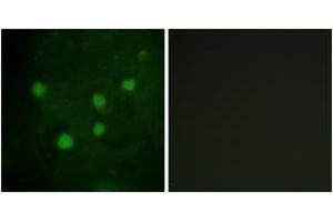 Immunofluorescence analysis of HuvEc cells, using BAF250B Antibody. (ARID1B 抗体  (AA 1371-1420))