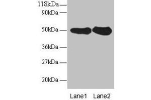 Western blot All lanes: RPN1 antibody at 2 μg/mL Lane 1: EC109 whole cell lysate Lane 2: 293T whole cell lysate Secondary Goat polyclonal to rabbit IgG at 1/15000 dilution Predicted band size: 50 kDa Observed band size: 50 kDa (RPN1 抗体  (AA 44-427))