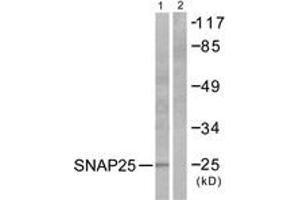 Western blot analysis of extracts from Raw264. (SNAP25 抗体  (AA 151-200))