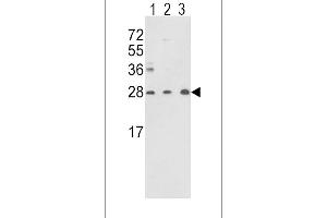 Western blot analysis of TPI1 Antibody (N-term) (ABIN389457 and ABIN2839524) in Y79(lane 1),CEM(lane 2) cell line and mouse brain tissue(lane 3) lysates (35 μg/lane). (TPI1 抗体  (N-Term))