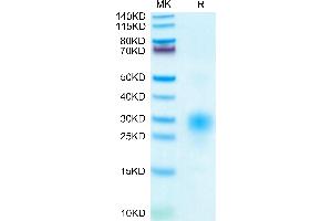 Human BST2 on Tris-Bis PAGE under reduced condition. (BST2 Protein (AA 49-161) (His tag))