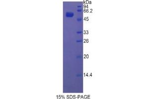 SDS-PAGE analysis of Rat Glucosidase beta , Acid Protein. (GBA 蛋白)