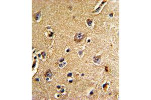 Immunohistochemistry (IHC) image for anti-Cell Division Cycle 23 (CDC23) antibody (ABIN3002712) (CDC23 抗体)