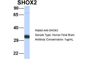 Host: Rabbit Target Name: SHOX2 Sample Type: Human Fetal Brain Antibody Dilution: 1. (SHOX2 抗体  (N-Term))