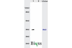 SDS-PAGE (SDS) image for anti-Interleukin 17 Receptor B (IL17RB) (AA 351-450) antibody (ABIN747968)