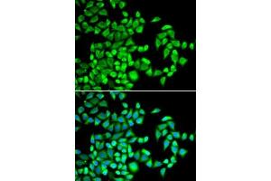 Immunofluorescence analysis of U2OS cells using  antibody (ABIN6131447, ABIN6136794, ABIN6136796 and ABIN6218313). (ALKBH1 抗体  (AA 110-389))