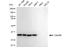 Western blotting analysis using C3orf38 antibody (ABIN7798078).