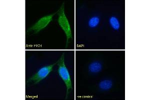 ABIN185667 Immunofluorescence analysis of paraformaldehyde fixed NIH3T3 cells, permeabilized with 0. (Patched 1 抗体  (Internal Region))