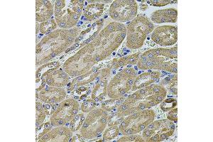 Immunohistochemistry of paraffin-embedded mouse kidney using ANXA8L2 antibody (ABIN5975720) at dilution of 1/100 (40x lens).