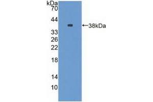 Detection of Recombinant NES, Rat using Polyclonal Antibody to Nestin (NES) (Nestin 抗体  (AA 197-462))