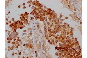IHC image of ABIN7127486 diluted at 1:100 and staining in paraffin-embedded human testis tissue performed on a Leica BondTM system. (Recombinant FDFT1 抗体)