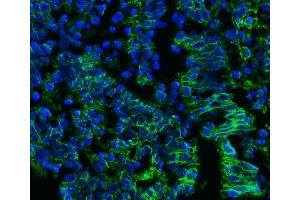 IF analysis of CD147/Emmprin using anti-CD147/Emmprin antibody (ABIN7599999).