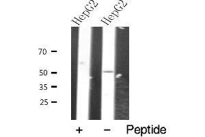 Western blot analysis of extracts from HepG2 cells, using VIPR2 antibody. (VIPR2 抗体  (Internal Region))