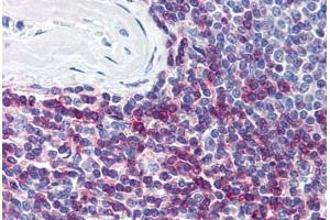 Human Spleen (formalin-fixed, paraffin-embedded) stained with CD7 antibody ABIN298827 at 5 ug/ml followed by biotinylated anti-mouse IgG secondary antibody ABIN481714, alkaline phosphatase-streptavidin and chromogen. (CD7 抗体)