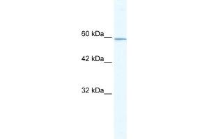 WB Suggested Anti-KLHL5 Antibody Titration:  5. (KLHL5 抗体  (N-Term))