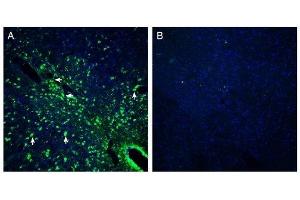 Expression of Presenilin-2 in mouse midbrain - Immunohistochemical staining of perfusion-fixed frozen mouse brain sections with Anti-Presenilin-2 Antibody (ABIN7043554, ABIN7044526 and ABIN7044527), (1:200), followed by goat anti-rabbit-AlexaFluor-488. (Presenilin 2 抗体  (Intracellular))