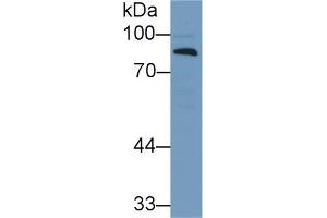 Western Blot; Sample: Human Lung lysate; Primary Ab: 1µg/ml Rabbit Anti-Human CFB Antibody Second Ab: 0. (Complement Factor B 抗体  (AA 270-388))
