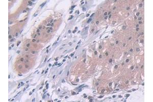DAB staining on IHC-P; Samples: Human Stomach Tissue (ADAMTS10 抗体  (AA 239-602))
