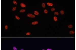 Immunofluorescence (IF) image for anti-SMAD, Mothers Against DPP Homolog 2 (SMAD2) (pSer423), (pSer425), (pSer465), (pSer467) antibody (ABIN7265256)