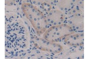DAB staining on IHC-P; Samples: Mouse Kidney Tissue