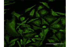 Immunofluorescence of monoclonal antibody to CAP1 on HeLa cell. (CAP1 抗体  (AA 1-475))