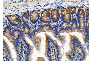 ABIN6257634 and ABIN6274771 at 1/100 staining Mouse colorectal tissue by IHC-P. (RPL18 抗体  (C-Term))