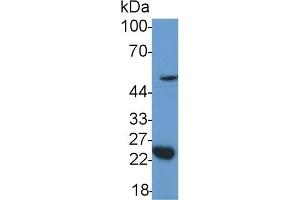 Detection of GDF11 in Mouse Cerebellum lysate using Polyclonal Antibody to Growth Differentiation Factor 11 (GDF11) (GDF11 抗体  (AA 299-407))