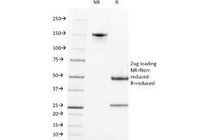 SDS-PAGE Analysis Purified CD21 / CR2 Mouse Monoclonal Antibody (CR2/1952). (CD21 抗体  (AA 44-196))