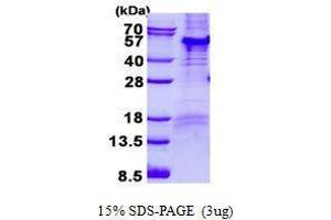 Figure annotation denotes ug of protein loaded and % gel used. (PARD6B 蛋白)