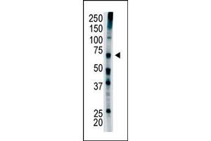 Image no. 1 for anti-Ubiquitin Specific Peptidase 22 (USP22) (C-Term) antibody (ABIN357559) (USP22 抗体  (C-Term))