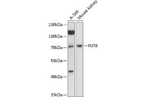 Western blot analysis of extracts of various cell lines, using FUT8 antibody (ABIN6132001, ABIN6140827, ABIN6140828 and ABIN6216749) at 1:3000 dilution. (FUT8 抗体  (AA 376-575))