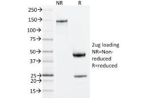 SDS-PAGE Analysis Purified ZAP70 Mouse Monoclonal Antibody (ZAP70/20535). (ZAP70 抗体  (AA 247-382))