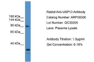 WB Suggested Anti-USP13  Antibody Titration: 0. (USP13 抗体  (N-Term))