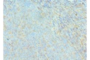 Immunohistochemistry of paraffin-embedded human tonsil tissue using ABIN7143076 at dilution of 1:100 (ACTR2 抗体  (AA 1-160))