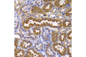 Immunohistochemistry of paraffin-embedded mouse kidney using PRKAB1 antibody (ABIN5995401) at dilution of 1/100 (40x lens). (PRKAB1 抗体)