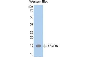 Detection of Recombinant SPTAN1, Human using Polyclonal Antibody to Alpha-Fodrin (SPTAN1) (SPTAN1 抗体  (AA 289-408))