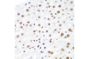 Immunohistochemistry of paraffin-embedded mouse liver using AGO2 antibody (ABIN5973585) at dilution of 1/100 (40x lens). (AGO2 抗体)