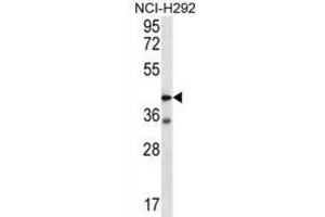 Western Blotting (WB) image for anti-Coagulation Factor II (thrombin) Receptor-Like 2 (F2RL2) antibody (ABIN2996634) (F2RL2 抗体)
