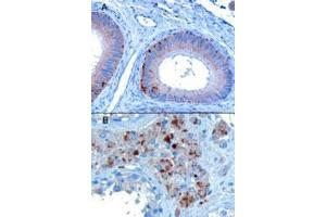 VPS35 polyclonal antibody  staining of paraffin embedded human testis showing A) Epithelial cells of the epididymis and B) Some leydig cells. (VPS35 抗体  (C-Term))