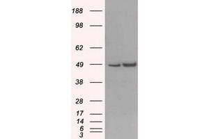 Western Blotting (WB) image for anti-LEM Domain Containing 3 (LEMD3) antibody (ABIN1499118) (LEMD3 抗体)