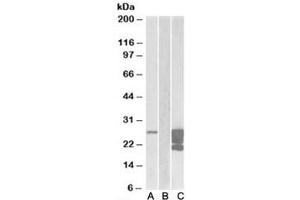 Western blot of HEK293 lysate overexpressing human GM2A-FLAG probed with GMA2 antibody (1ug/ml) in Lane A and anti-FLAG (1/30000) in lane C. (GM2A 抗体)