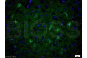Formalin-fixed and paraffin embedded rat brain tissue labeled with Anti-NOS-2/iNOS Polyclonal Antibody, Unconjugated (ABIN677228) at 1:200 followed by conjugation to the secondary antibody Goat Anti-Rabbit IgG, FITC conjugated used at 1:200 dilution for 40 minutes at 37°C and DAPI (NOS2 抗体  (AA 14-100))