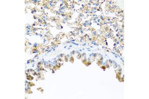 Immunohistochemistry of paraffin-embedded mouse lung using PI3 antibody at dilution of 1:100 (40x lens). (PI3 抗体)