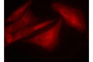 Immunofluorescence staining of methanol-fixed Hela cells using G3BP-1(Phospho-Ser232) Antibody. (G3BP1 抗体  (pSer232))